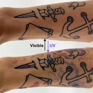 An arm tattoo before and after light activates PhotoTat pigments
